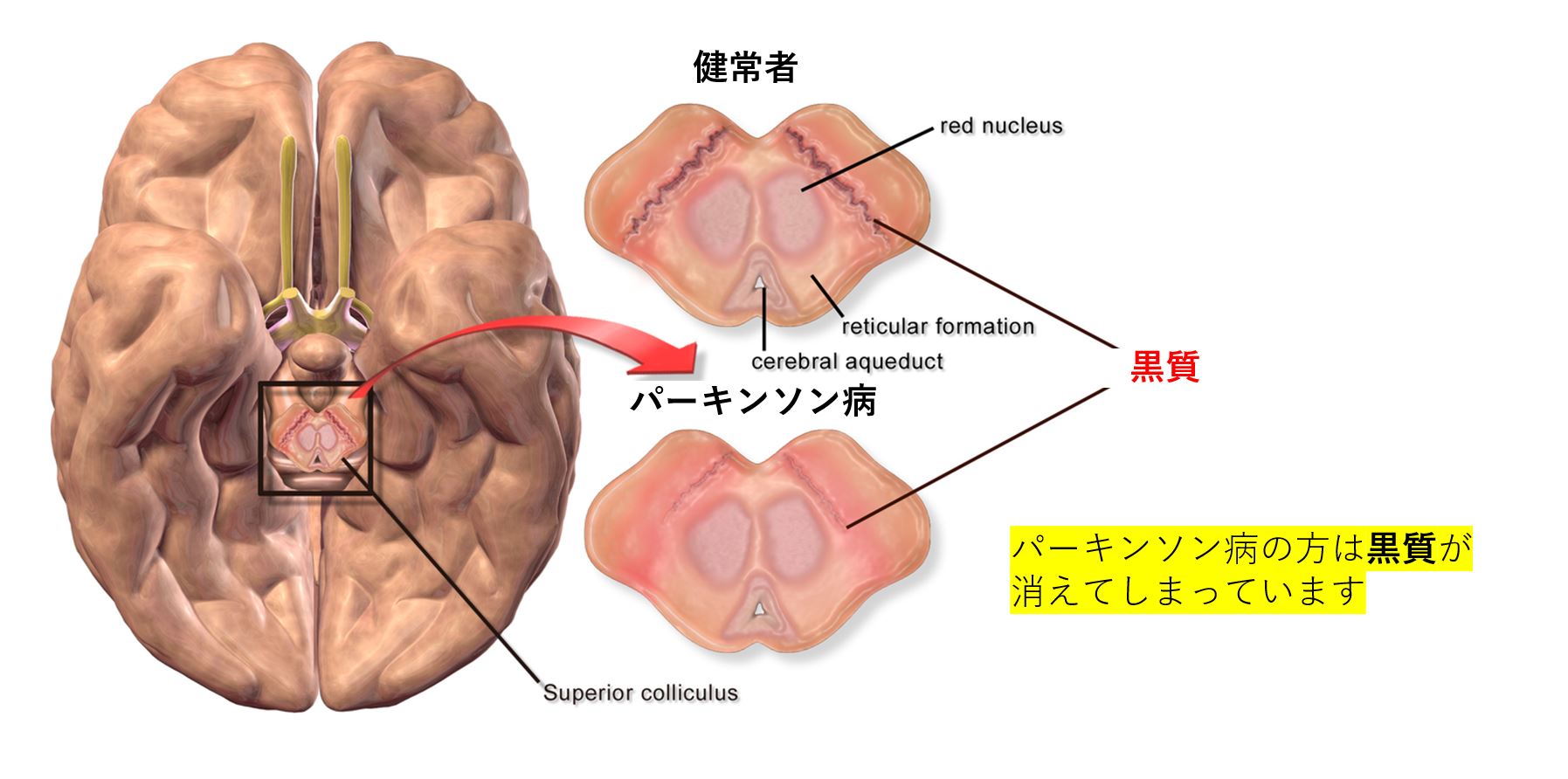 日常生活のヒント