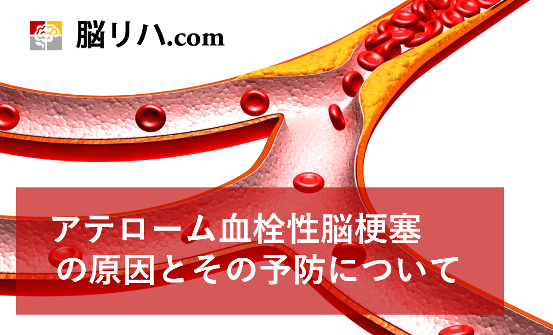 血栓性脳卒中の症状